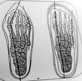 ayak sağlığının bozulması